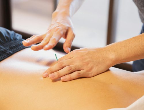 Czym się różni fizjoterapia od rehabilitacji?